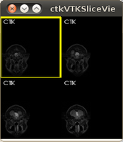 ctkVTKSliceView A QVTKRenderWidget to display 2D images (support lightbox mode)